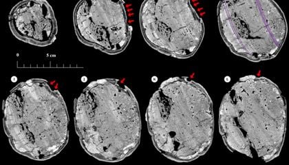 This Young Woman With a Cone-Shaped Skull Died After Suffering a Severe Head Wound 6,000 Years Ago