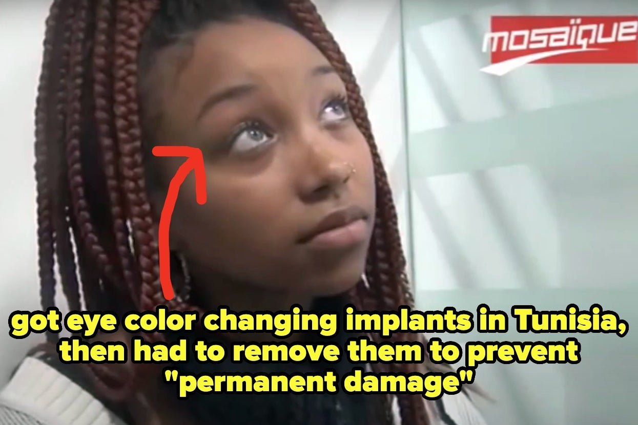 34 Celebs Who Removed Their Breast, Butt, And Eye Implants (And Why)